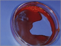 PRP